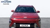 Hyundai Kona 1.0T 100CV 48V Tecno