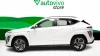 Hyundai Kona EV 150kW 65kWh N Line