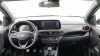 Hyundai i10 1.2 N LINE 84 5P