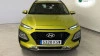 Hyundai Kona 1.6 CRDI 85kW (115CV) Klass 4X2