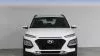 Hyundai Kona 1.6 TGDI 141 CV KLASS