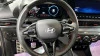 Hyundai i20 1.2 MPI N Line