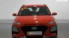 Hyundai Kona 1.0 TGDi Klass 4x2
