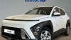 Hyundai Kona 1.0 TGDI Tecno