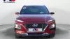 Hyundai Kona 1.0 TGDI Tecno Red 4X2