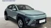 Hyundai Kona 1.0 TGDI Maxx