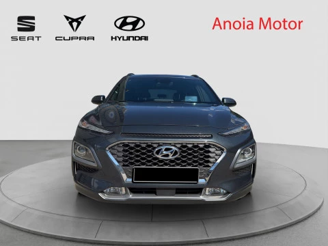 Hyundai Kona 1.6 GDI HEV Tecno Red DT